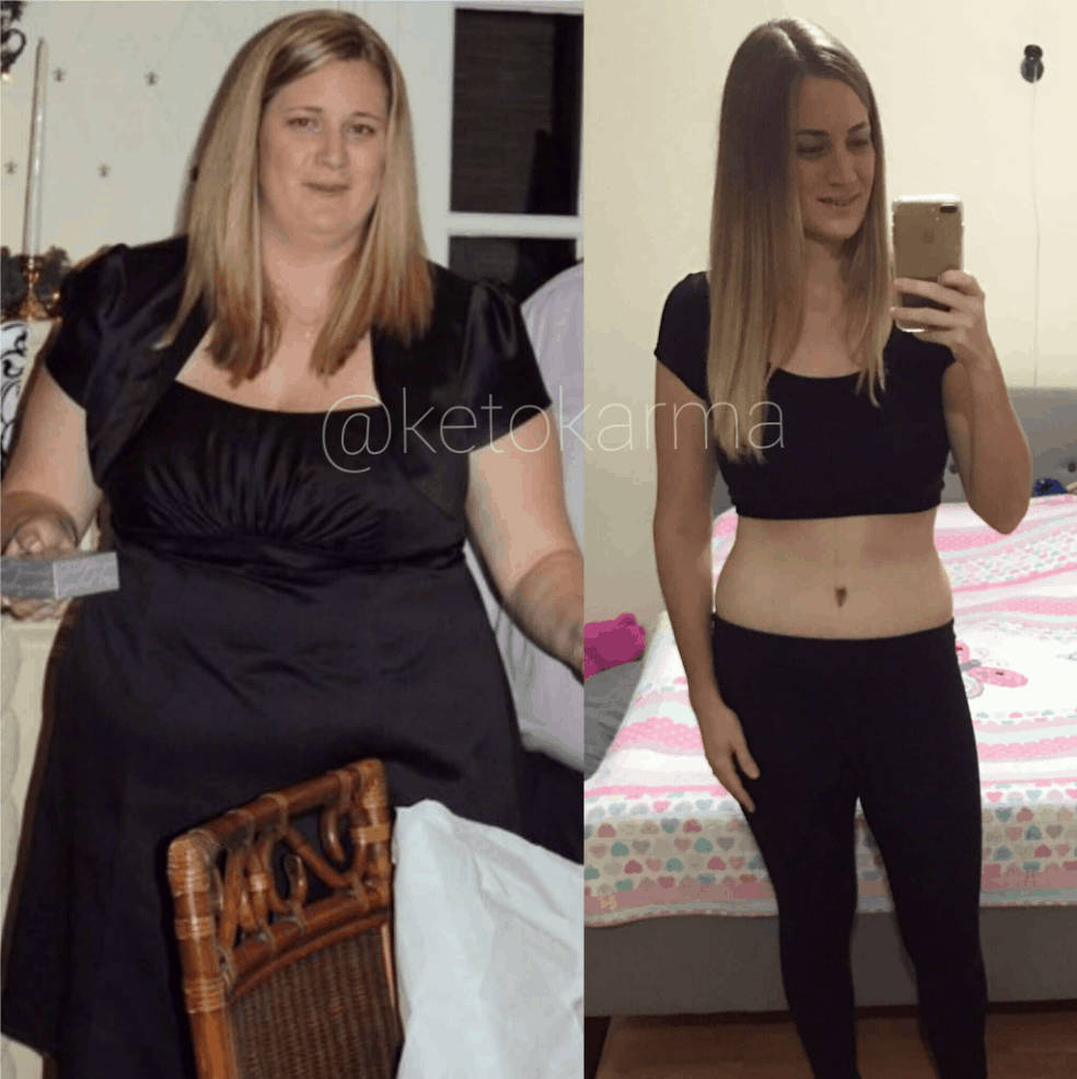 Suzanna ryan has a food addiction and couldn't stick to a diet. Since then she lost over 100 pounds following a keto diet! She now shares her weight loss transformation in her cookbook, simply keto, and her blog. Keto Karma