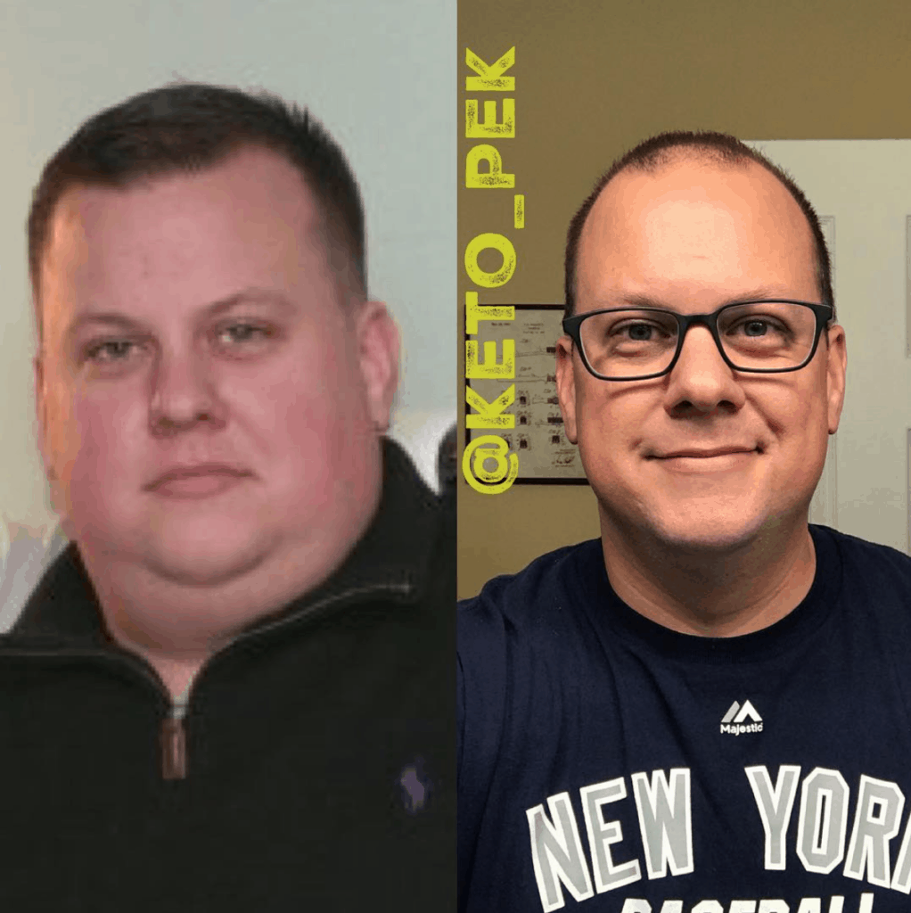 Steve Pekar has tried various diets but keto was the only one that was successful at helping him lose 115 pounds in a year!